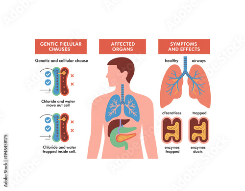 An infographic illustrating the genetic causes, affected organs, and symptoms of cystic fibrosis on transparent background