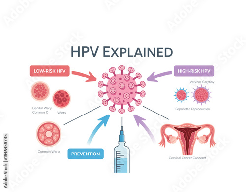 A detailed illustration explaining HPV, its risks, and prevention methods on transparent background