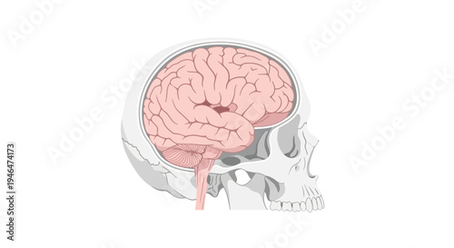 The human skull with the brain exposed is shown in a medical illustration from the side view.