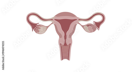 The image depicts a detailed illustration of a female reproductive system including the uterus fallopian tubes and ovaries in a medical context.
