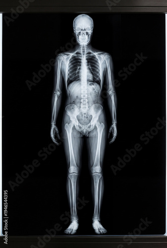 a full-frame shot of an x-ray image showcasing a detailed skeletal structure