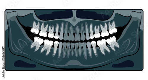 Dental X-ray of human teeth with a dark green background.