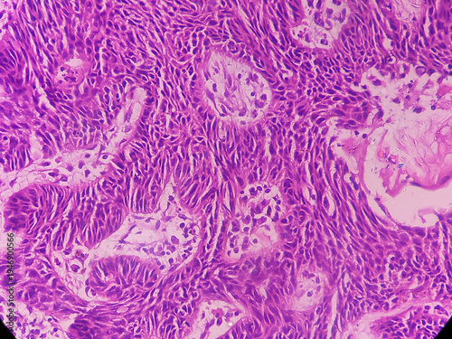 Принти на полотні Tissue from left auricle