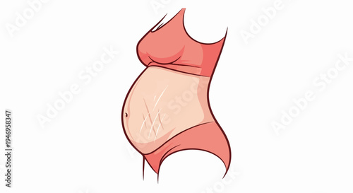 Cartoon illustration of a pregnant woman's torso, featuring a prominent belly with visible stretch marks
