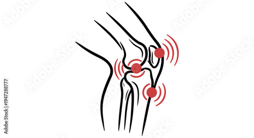 An illustration of a knee joint with highlighted areas of pain and inflammation.