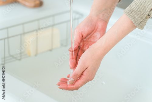 Photos A woman's bright red, chapped hands from doing dishes in the kitchen