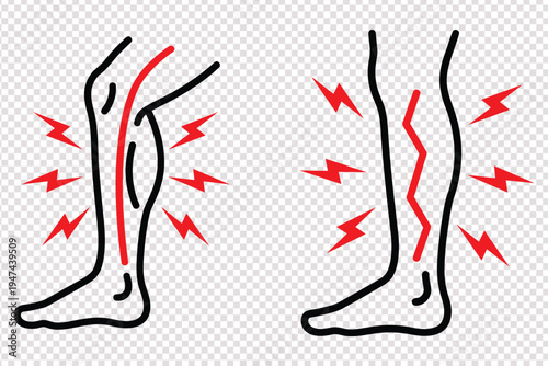 Medical illustration of leg pain and discomfort indicated by red lightning bolts and highlighted veins