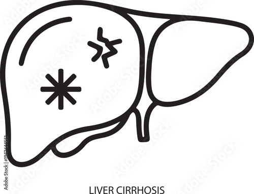 Liver Cirrhosis Medical Condition Vector Icon Illustration for Healthcare, Disease, and Organ Health Concepts