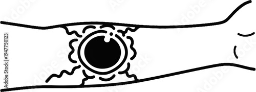 Stylized black and white illustration of an eye in a blood vessel