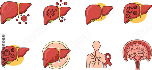 Liver Disease and Medical Anatomy Illustration Set with Healthy Liver, Infected Liver, Virus Particles and Healthcare Awareness Vector Collection