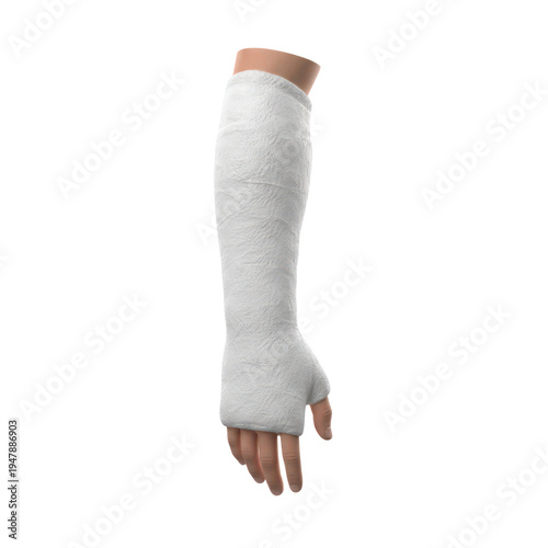White plaster arm cast on human hand and forearm isolated