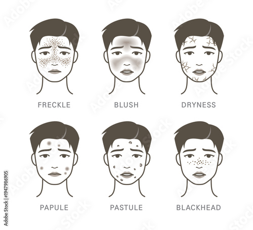 acne, acne scar, acne type, aesthetic, allergic, allergy, appearance, avatar, beauty, black head, blackhead, blemish, blush, burn, character, comedo, condition, cosmetic, dermatology, dry skin, drynes