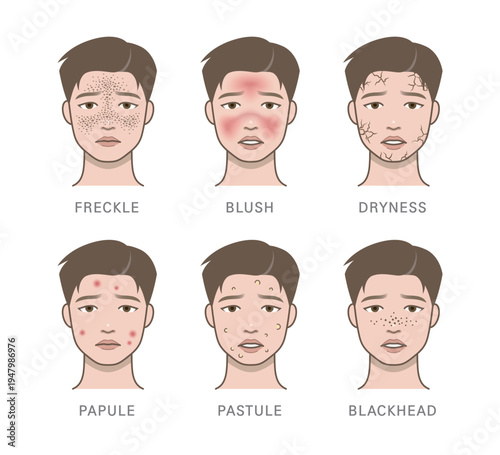 acne, acne scar, acne type, aesthetic, allergic, allergy, appearance, avatar, beauty, black head, blackhead, blemish, blush, burn, character, comedo, condition, cosmetic, dermatology, dry skin, drynes