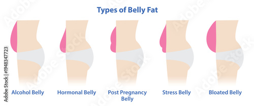 Types of belly fat vector illustration isolated on white background. Comparison of women with alcohol, hormonal, post pregnancy, stress and bloated belly. Body type, health, weight problem concept.