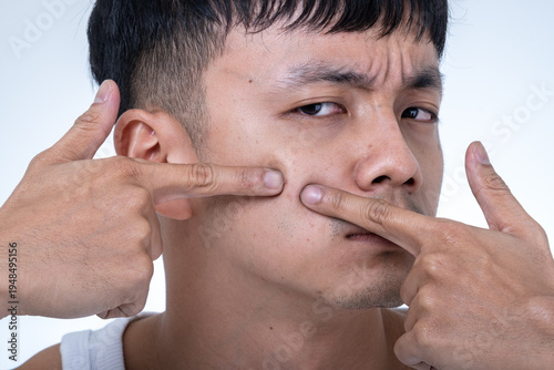 Young Asian man in a white tank top points at his cheek with both hands, showing a concerned skincare expression against a light gray studio background