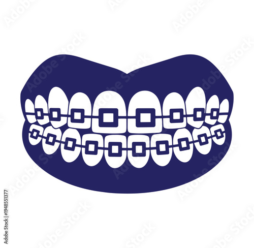 Dental braces on teeth with metal brackets and wires on white background