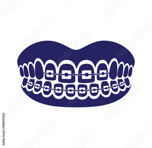 Dental braces on teeth with metal wires and brackets on white background