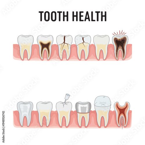 Educational medical infographic showing various stages of tooth decay, gum disease, and dental treatment options.