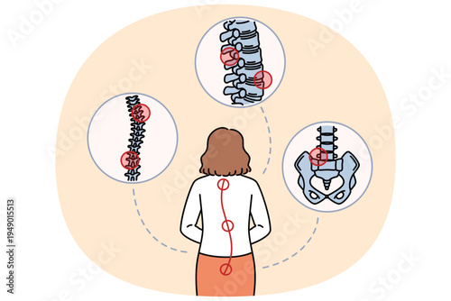 Woman with sore spine stands with back to camera and needs help of massage therapist or osteopath. Businesswoman sore spine appeared as result of sedentary lifestyle and bad office chair.