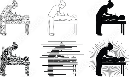 Acupuncture therapy silhouette styles, wellness treatment poses, artistic healthcare scenes, vector set, editable stroke, professional concept, black and white design