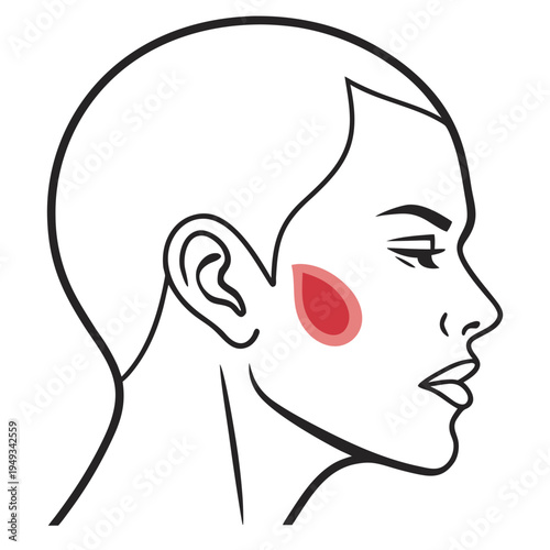 A vector graphic illustration of a woman's head with a red spot on her cheek