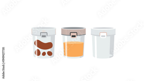 Jars for medical tests containing stool and urine samples alongside an empty container for collection purposes.