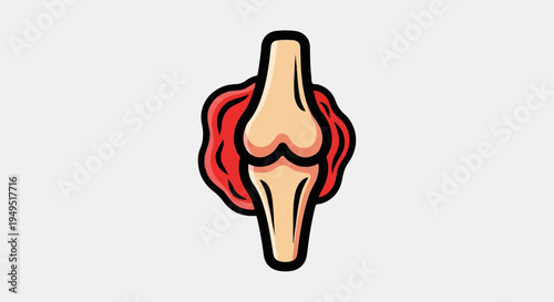 Human Knee Joint Anatomy Illustration with Red Inflammation.