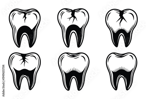 Tooth decay and dental problems vector set, cracked and damaged teeth collection