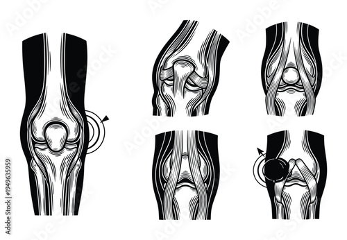 Knee joint anatomy and pain point illustration set on transparent background