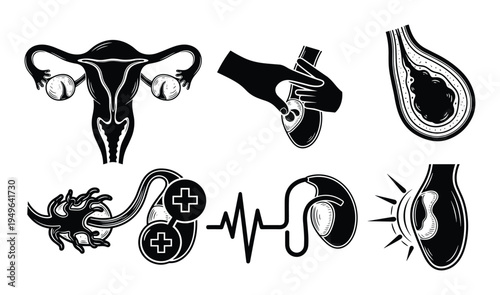 Set of human reproductive system and medical treatment illustrations, featuring female anatomy and procedures