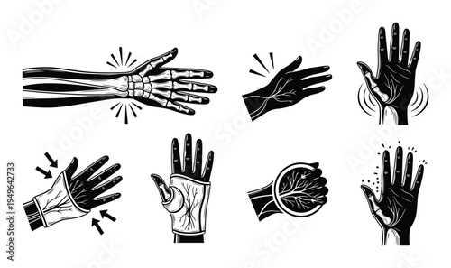 Hand and wrist anatomy bones and veins medical illustration pain relief