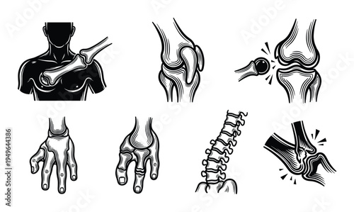 Orthopedic joint injury icons collection featuring knee shoulder hand and spine dislocation and pain