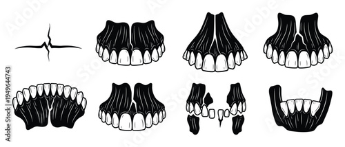 Dental surgery and jaw fracture collection showing broken teeth and maxillary trauma