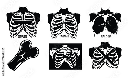 Collection of chest trauma illustrations including complete, partian and flail chest injuries