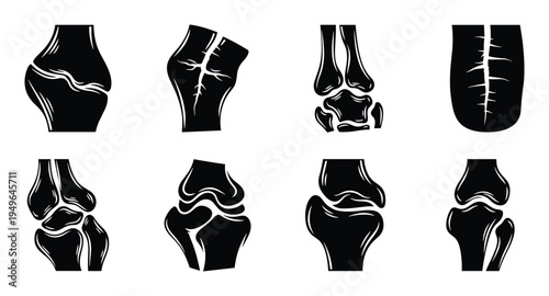 Various knee and leg bone joint conditions including arthritis and cartilage wear icons