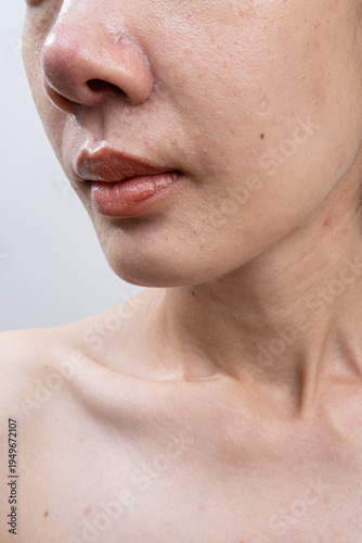 Close-up of asian female face showing natural skin texture, enlarged pores, and blemishes on a white background. Ideal for skincare and real beauty concepts. Vertical Shot