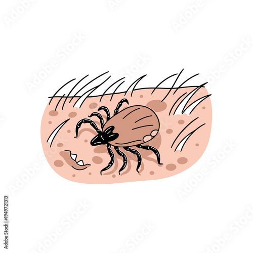 Tick Bites a Skin Patch with Hair vector illustration