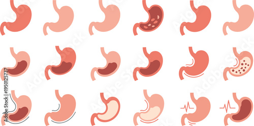 Human stomach anatomy icon collection showing digestion gastric problems acid reflux medical healthcare flat vector illustration set