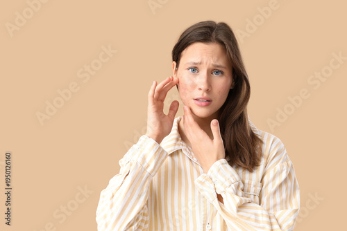 Young woman with acne probl...