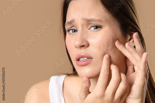 Young woman with acne probl...