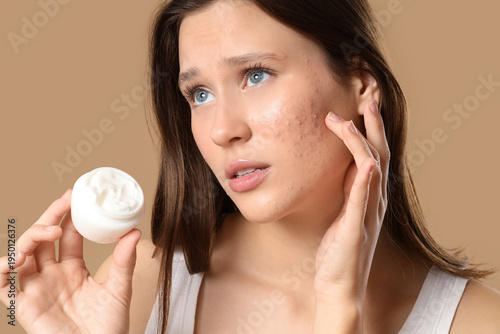 Young woman with acne probl...