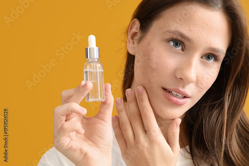 Young woman with acne probl...