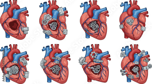Human heart with mechanical gears concept medical technology bioengineering anatomy flat vector illustration collection