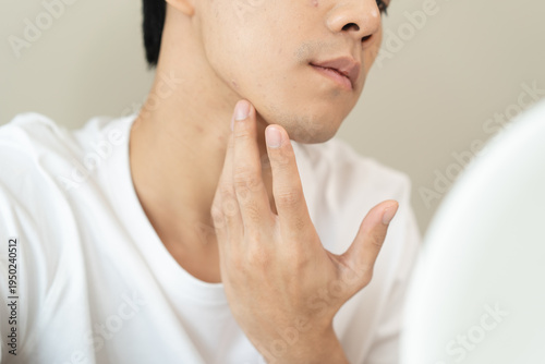Photos Asian men worry about acne on their faces when looking in the mirror