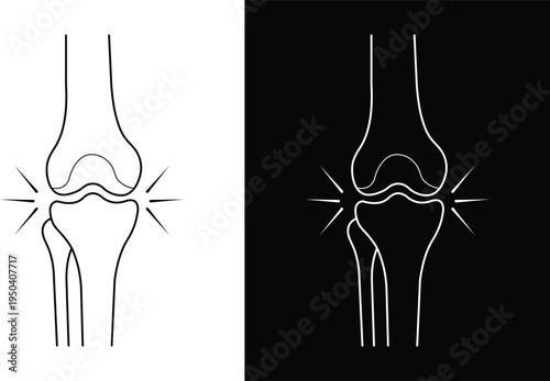 Knee joint pain and inflammation medical illustration.