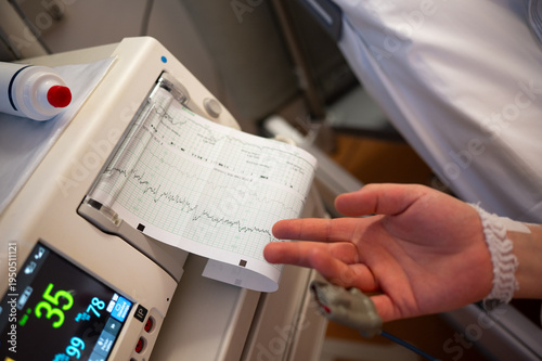 Messgerät im krankenhaus, technische Geräte im Kreissaal. Klinik. Gebucht.