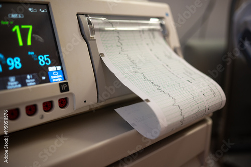 Ein EKG Messgerät spuckt Papier aus. Messungen im Krankenhaus.