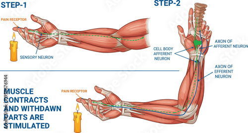 Vector illustration of reflex arc showing pain receptor, sensory neuron, spinal cord processing, and muscle contraction response