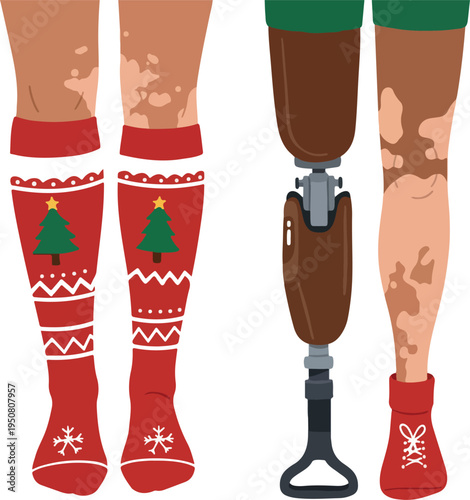 Christmas Socks and Prosthetic Leg with Vitiligo Pattern Flat Design