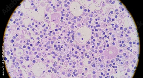 Microscopic view of various biological cells stained in purple and pink for medical analysis